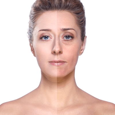 DULL & UNEVEN SKIN TONE - Medigo Aesthetic